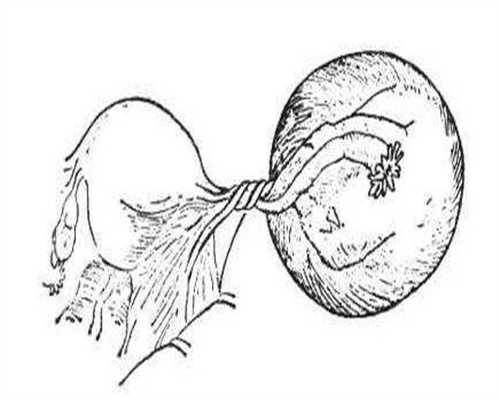 广东三代供卵试管婴儿代怀生子医院排名,附费用成功率参考