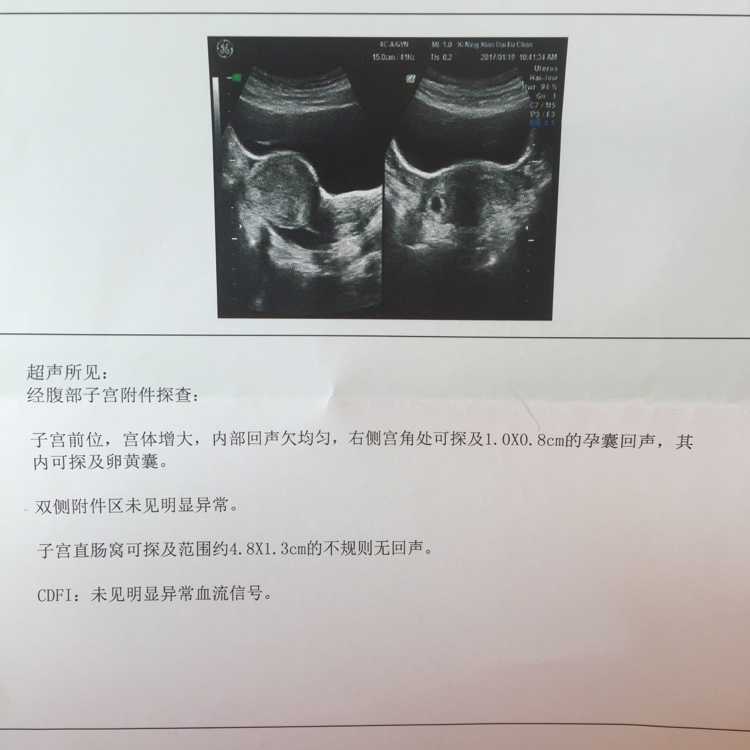 广州代孕中介违法不，广州二胎备孕男娃