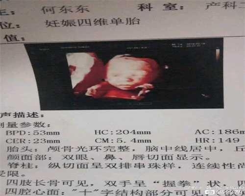 基因检测卵巢发育不全,合法代孕哪家公司好北京