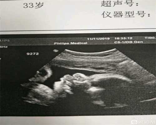 广州高鹰助孕上海世纪代怀孕地址,怀助孕代孕宝