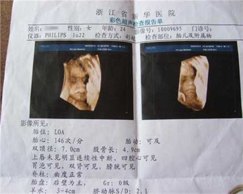 广州高鹰助孕上海世纪代怀孕育婴,紧闭门窗洗澡