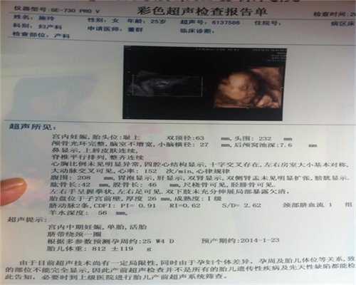 广州高鹰助孕中信湘雅试管费用,教您如何看懂孕