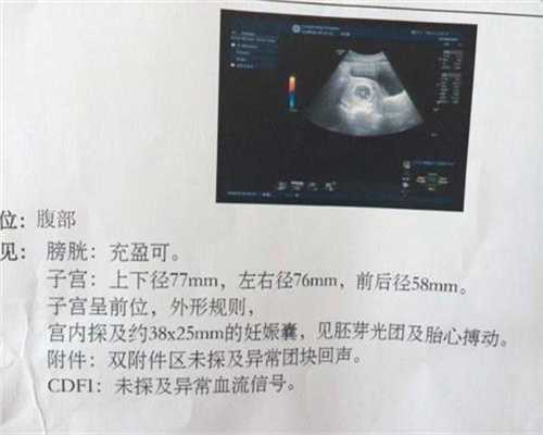 广州高鹰助孕试管婴儿取卵子痛苦吗,代怀孕前药