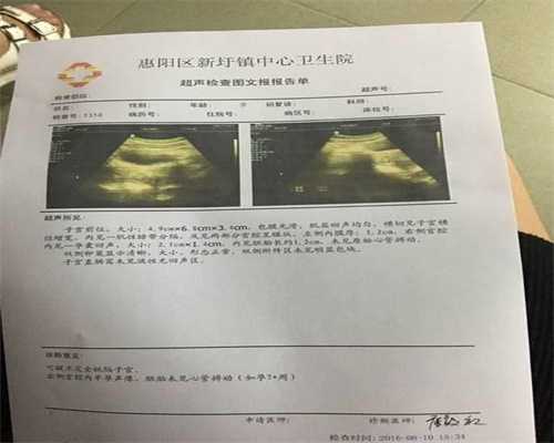 广州高鹰助孕我私人想找个怀孕的,保证代怀孕代