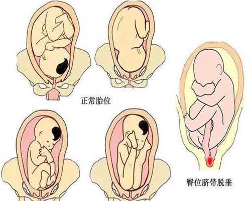 广州高鹰助孕我私人想找个怀孕的,保证代怀孕代