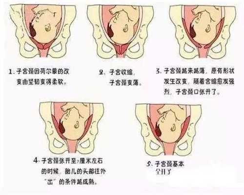 广州高鹰助孕三代试管婴儿一次成功,教你如何从
