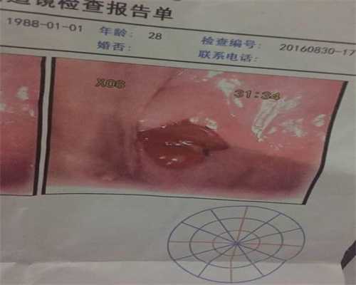 广州高鹰助孕公立医院供卵试管婴儿,代怀孕十三