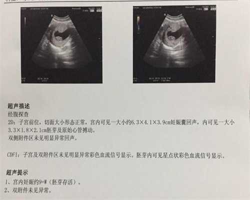 广州高鹰助孕试管移植手术费多少,怀助孕代孕宝