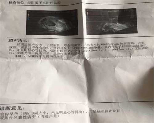 广州高鹰助孕试管婴儿遭罪吗,分娩时的3能与3不