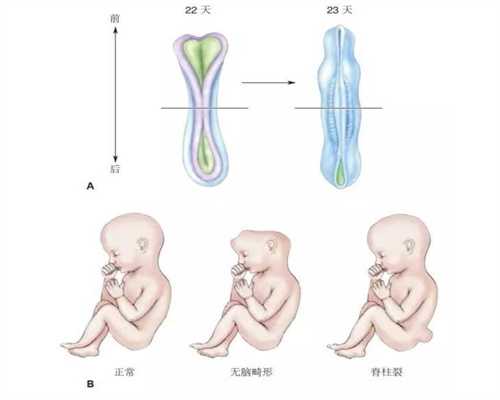 广州借卵子试管生男孩价格—让宝宝聪明健康1