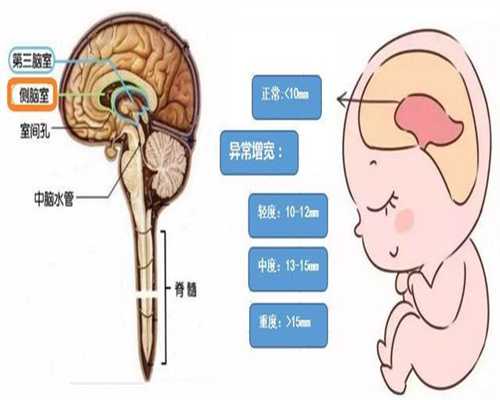 广州试管婴儿代孕价格-代怀孕产妇卫生巾