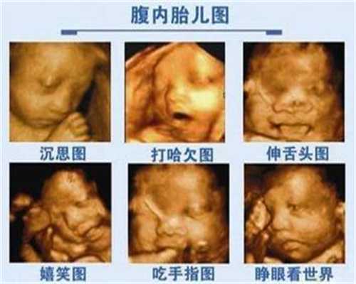 广州做试管婴儿的流程视频_广州想生男孩男子徒