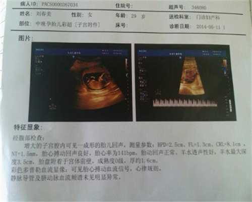 广州高鹰助孕试管婴儿的痛苦经历,代怀孕代孕妈