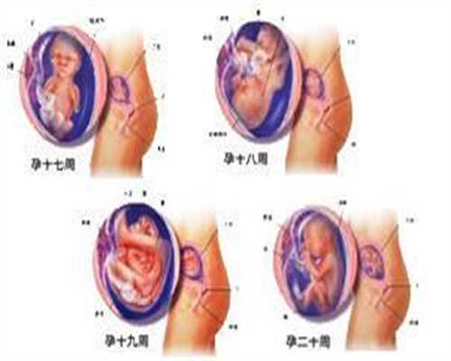广州代孕志愿者价格-输卵管造影检查痛不痛