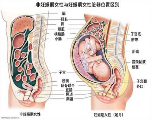广州高鹰助孕从检查到做试管要多久,怀助孕代孕