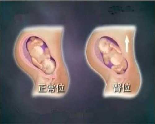 广州代孕要检查什么-广州哪里有代孕医院-验孕棒显示无效的原因是什么