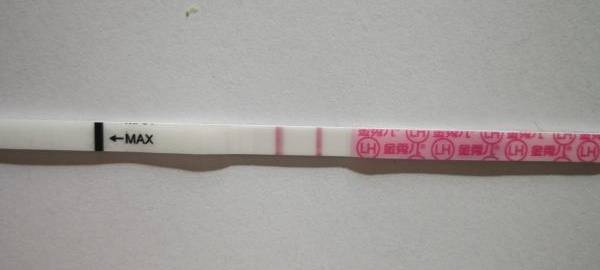 广州供卵试管婴儿助孕，多囊卵巢综合症的症状有哪些？