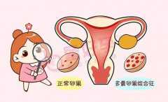 广州借卵子医院~广州47借卵自怀~，孕妇发烧可以冰敷额头吗